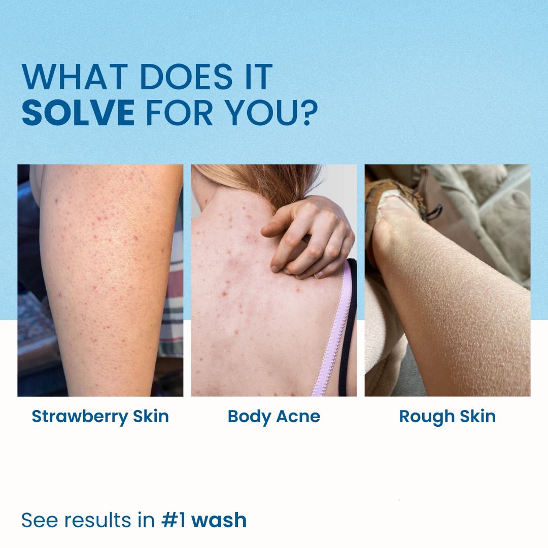 DUNE NATURALS©- Good Vibes Salicylic Acid Body Wash