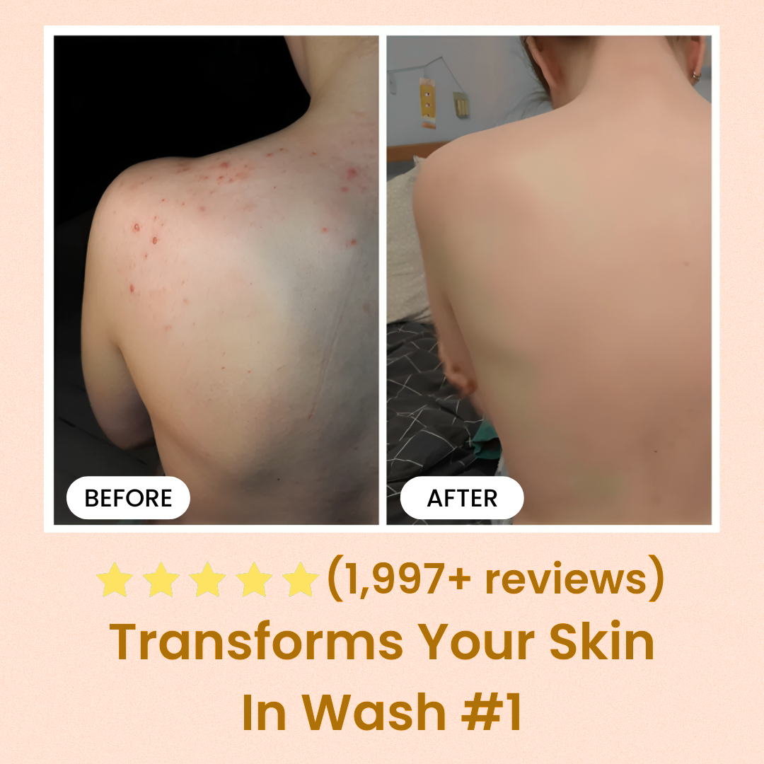 DUNE NATURALS©- Sun Kissed Kojic Acid Body Wash