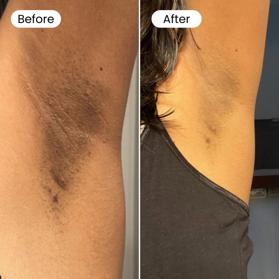 Lightening Body Cream - Rapid Repair